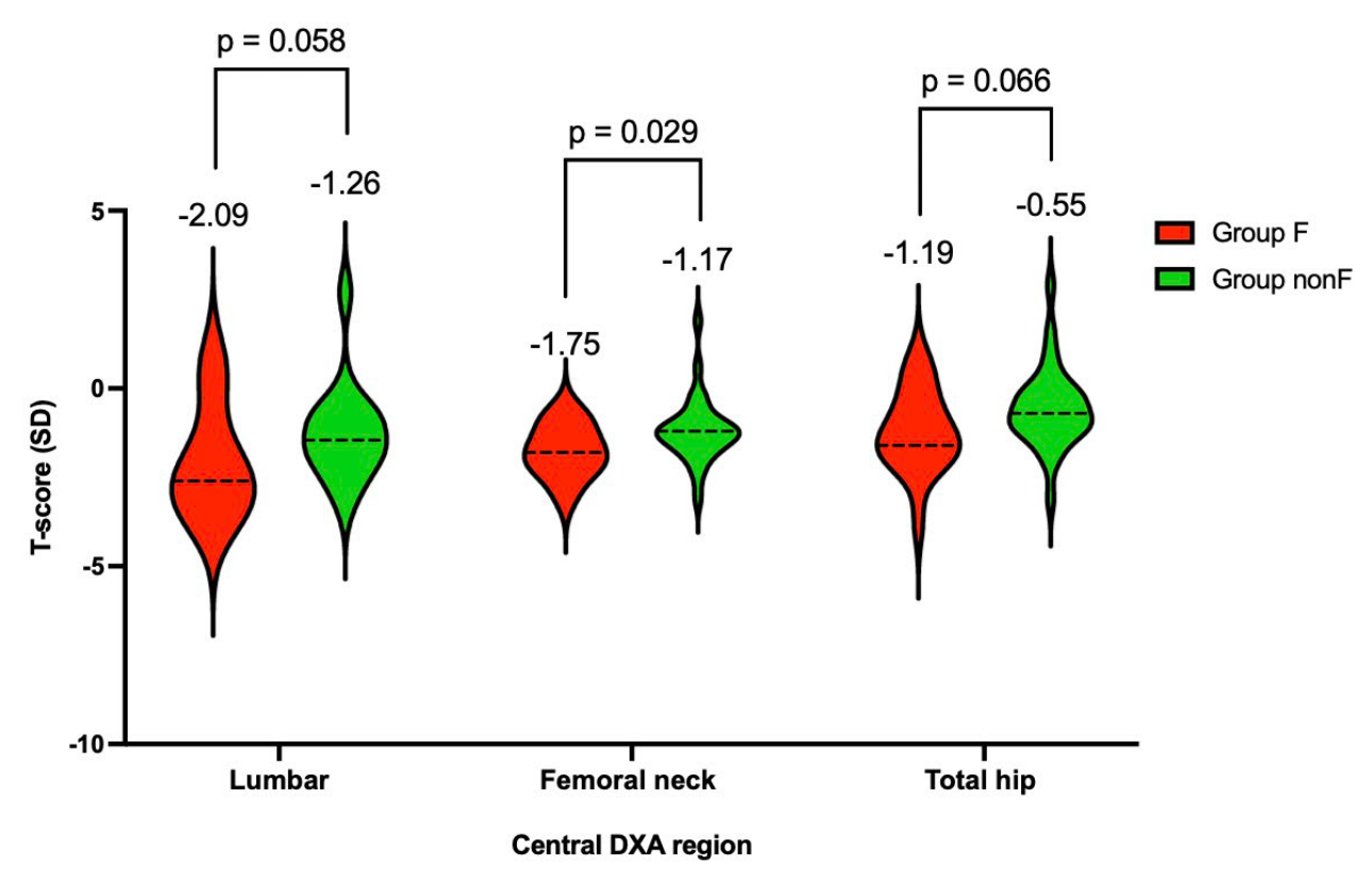 Violin plot of lumbar, femoral neck and total hip T-score in group F and group nonF
