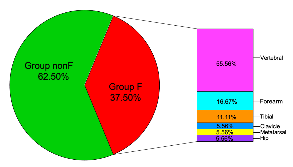 Bar of pie chart showing the frequency of fragility fracture location in group F, split from the group F 37.50 percent slice