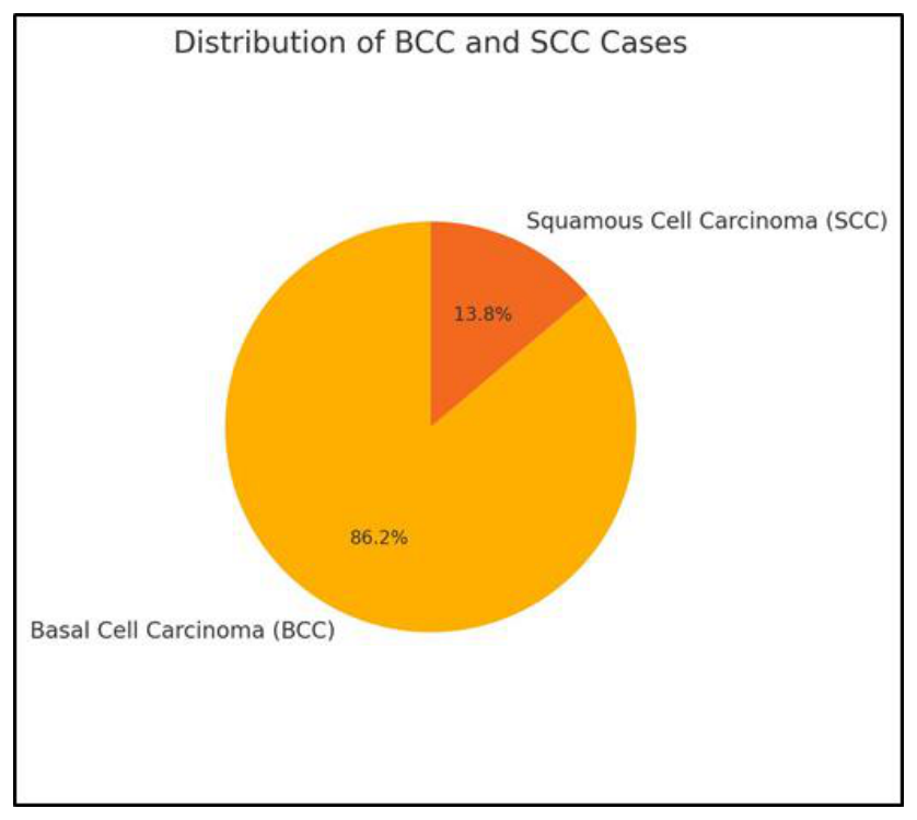 Distribution of non-melanoma skin cancers cases