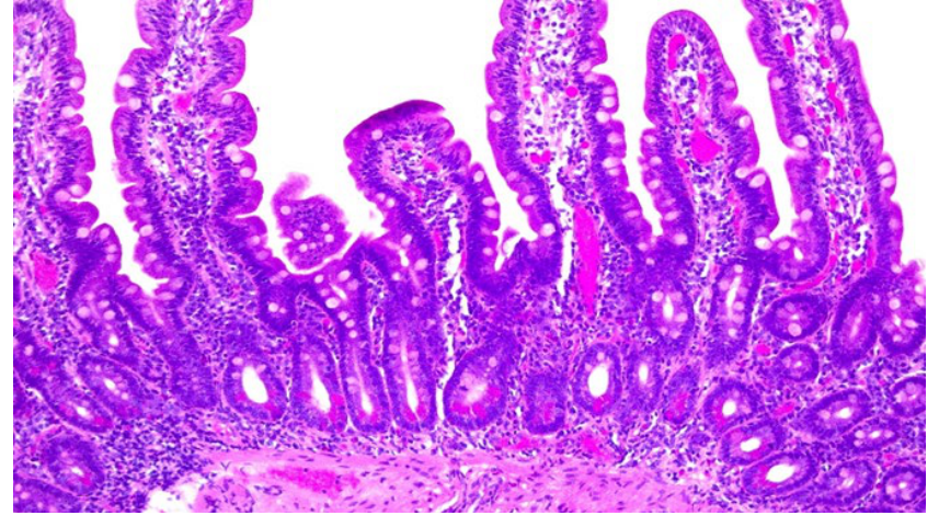 Photomicrograph of Paneth cells at the base of normal small bowel mucosa, HE stain, 100x magnification.